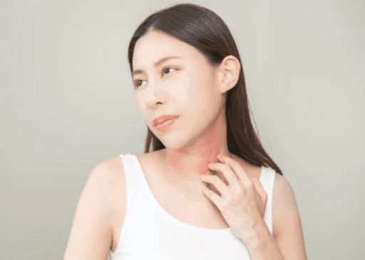 多様な要因に配慮する 皮膚と神経のセルフケア― 湿疹などの肌トラブルと付き合いながら、お風呂時間を味方にする ―